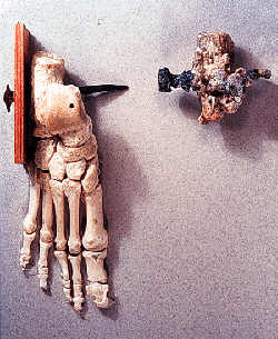 The Crucified Man Bone
